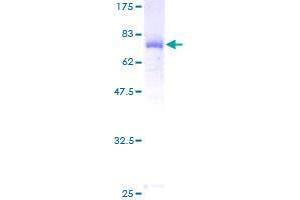 ARMC6 Protein (AA 1-476) (GST tag)