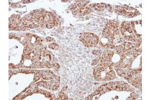 IHC-P Image Immunohistochemical analysis of paraffin-embedded NCI-N87 xenograft, using ACADM, antibody at 1:500 dilution. (Medium-Chain Specific Acyl-CoA Dehydrogenase, Mitochondrial (Center) Antikörper)