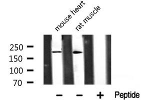 Western blot analysis of TAF1 Antibody expression in mouse heart and rat muscle tissues lysates. (TAF1 Antikörper  (Internal Region))