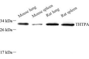 Western blot analysis of THTPA (ABIN7075879),at dilution of 1: 800