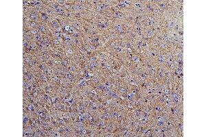 IHC analysis of Hexokinase 1/HK1 using anti-Hexokinase 1/HK1 antibody (ABIN7600260). (Hexokinase 1 Antikörper  (AA 17-323))