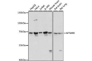 Western blot analysis of extracts of various cell lines, using MTMR9 antibody. (MTMR9 Antikörper  (AA 1-250))