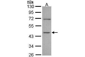 WB Image Sample (30 ug of whole cell lysate) A: A431 , 10% SDS PAGE antibody diluted at 1:1000 (ITPK1 Antikörper)