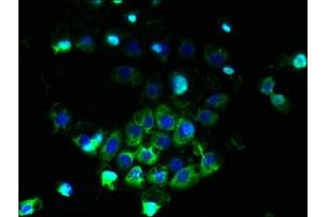Immunofluorescent analysis of A431 cells using ABIN7144889 at dilution of 1:100 and Alexa Fluor 488-congugated AffiniPure Goat Anti-Rabbit IgG(H+L) (ABCB5 Antikörper  (AA 547-760))