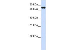 WB Suggested Anti-ZFYVE1 Antibody Titration:  0. (ZFYVE1 Antikörper  (C-Term))