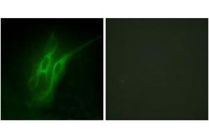 Immunofluorescence analysis of HeLa cells, using 5-HT-4 Antibody. (Serotonin Receptor 4 Antikörper  (AA 21-70))