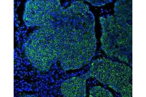 anti-Keratin 5 (KRT5) (Middle Region) antibody