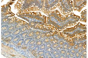ABIN6260226 and ABIN6269334 at 1/100 staining Rat colon tissue by IHC-P.