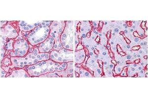 Anti collagen IV antibody (1:400, 45 min RT) showed strong staining in FFPE sections of human kidney (Left) with strong red staining observed in glomeruli and liver (Right) with strong staining in sinusoids. (Collagen IV Antikörper)
