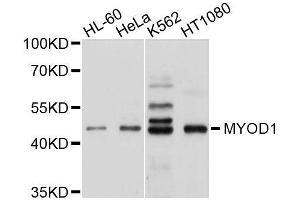 Western blot analysis of extracts of various cell lines, using MYOD1 antibody. (MYOD1 Antikörper  (AA 150-250))