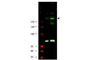 Image no. 1 for anti-Insulin Receptor Substrate 1 (IRS1) (pSer307) antibody (ABIN199910) (IRS1 Antikörper  (pSer307))