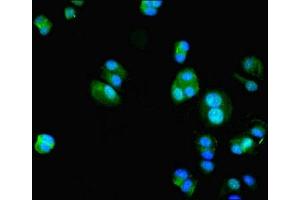 Immunofluorescent analysis of MCF-7 cells using ABIN7156025 at dilution of 1:100 and Alexa Fluor 488-congugated AffiniPure Goat Anti-Rabbit IgG(H+L) (HIF1AN Antikörper  (AA 2-254))