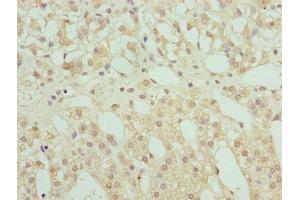 Immunohistochemistry of paraffin-embedded human adrenal gland tissue using ABIN7168234 at dilution of 1:100 (RING1 Antikörper  (AA 401-630))