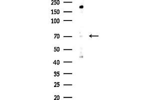 Western blot analysis of lysates from COLO205 cells, using NUAK2 Antibody at 1/1000 dilution.
