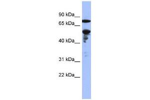 WB Suggested Anti-ZNF549  Antibody Titration: 0. (ZNF549 Antikörper  (Middle Region))