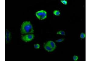 Immunofluorescence staining of MCF-7 cells with ABIN7168803 at 1:166, counter-stained with DAPI. (SEMA4D/CD100 Antikörper  (AA 756-862))