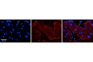 Rabbit Anti-AKAP7 Antibody    Formalin Fixed Paraffin Embedded Tissue: Human Adult heart  Observed Staining: Membrane Primary Antibody Concentration: 1:600 Secondary Antibody: Donkey anti-Rabbit-Cy2/3 Secondary Antibody Concentration: 1:200 Magnification: 20X Exposure Time: 0.