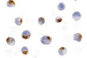 Immunohistochemistry (IHC) image for anti-Apoptotic Chromatin Condensation Inducer 1 (ACIN1) (Middle Region) antibody (ABIN1030843) (ACIN1 Antikörper  (Middle Region))