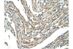FBXL5 antibody was used for immunohistochemistry at a concentration of 4-8 ug/ml to stain Skeletal muscle cells (arrows) in Human Muscle. (FBXL5 Antikörper  (Middle Region))