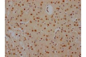 IHC image of ABIN7127503 diluted at 1:100 and staining in paraffin-embedded human brain tissue performed on a Leica BondTM system. (Rekombinanter FUBP1 Antikörper)