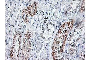 Immunohistochemical staining of paraffin-embedded Human Kidney tissue using anti-SIRT5 mouse monoclonal antibody. (SIRT5 Antikörper)