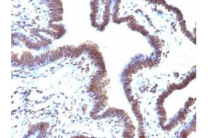 Immunohistochemistry (IHC) image for anti-F-Box Protein 5 (FBXO5) (AA 1-250) antibody (ABIN6939501)