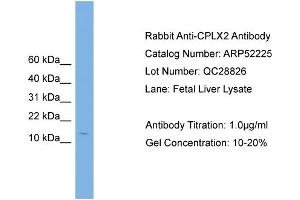 WB Suggested Anti-CPLX2  Antibody Titration: 0.