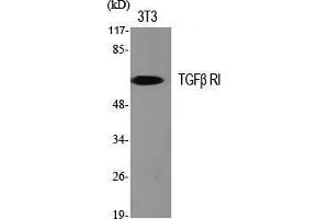 Western Blot (WB) analysis of specific cells using TGFbeta RI Polyclonal Antibody. (TGFBR1 Antikörper  (Tyr159))