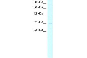 WB Suggested Anti-ASGR2 Antibody Titration:  4. (Asialoglycoprotein Receptor 2 Antikörper  (N-Term))