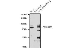 Immunoprecipitation analysis of 600 μg extracts of Rat testis cells using 3 μg FB2 antibody (ABIN7267111). (FAM160B2 Antikörper)