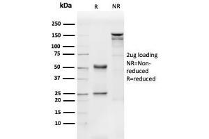 SDS-PAGE Analysis Purified CD31 Mouse Monoclonal Antibody (PECAM1/3540). (CD31 Antikörper  (AA 625-738))