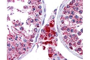 SFTPC antibody was used for immunohistochemistry at a concentration of 4-8 ug/ml. (Surfactant Protein C Antikörper  (N-Term))