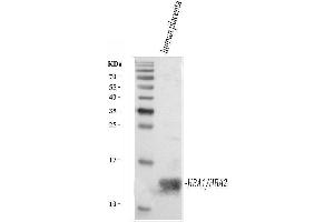 Western blot analysis of Hemoglobin using anti-Hemoglobin antibody (ABIN5518839). (HBA1 Antikörper  (AA 2-142))