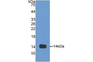 Detection of Recombinant OLFM4, Rat using Polyclonal Antibody to Olfactomedin 4 (OLFM4) (Olfactomedin 4 Antikörper  (AA 405-511))