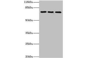 Western blot All lanes: ZNF699 antibody at 2 μg/mL Lane 1: Jurkat whole cell lysate Lane 2: K562 whole cell lysate Lane 3: U87 whole cell lysate Secondary Goat polyclonal to rabbit IgG at 1/10000 dilution Predicted band size: 74 kDa Observed band size: 74 kDa (ZNF699 Antikörper  (AA 19-195))