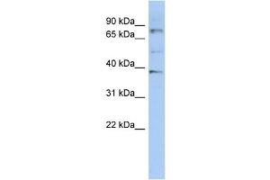WB Suggested Anti-OAS2 Antibody Titration:  0. (OAS2 Antikörper  (N-Term))
