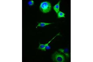 Immunofluorescence staining of MCF-7 cells with ABIN7159217 at 1:100, counter-stained with DAPI. (MC5 Receptor Antikörper  (AA 1-37))