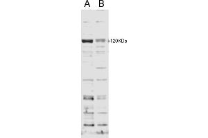 ABIN185714 staining of HFF cell lysate with B) 100nM siRNA or A) control siRNA.