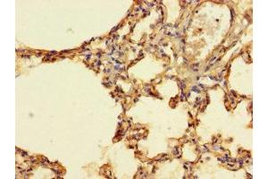Immunohistochemistry of paraffin-embedded human lung tissue using ABIN7156574 at dilution of 1:100 (IFI27L2 Antikörper  (AA 87-130))
