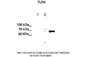 Lanes:  Lane 1: Untreated human U251 cell lysate Lane 2: IL-1beta treated human U251 cell lysate Primary Antibody Dilution:  1:500 Secondary Antibody:  Anti-rabbit-HRP Secondary Antibody Dilution:  1:500 Gene Name:  TLR4 Submitted by:  Anonymous (TLR4 Antikörper  (C-Term))