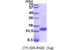CST5 Protein (AA 26-142) (His tag)