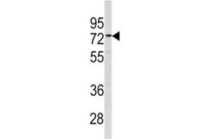 Western blot analysis of CEA antibody and 293 lysate (CEA Antikörper  (AA 400-429))