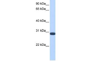 WB Suggested Anti-DUSP19 Antibody Titration: 0. (DUSP19 Antikörper  (C-Term))