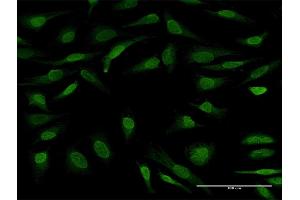 Immunofluorescence of purified MaxPab antibody to UBL7 on HeLa cell. (UBL7 Antikörper  (AA 1-380))