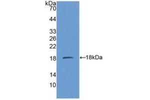 Detection of Recombinant SDHD, Mouse using Polyclonal Antibody to Succinate Dehydrogenase Complex Subunit D (SDHD) (SDHD Antikörper  (AA 1-159))