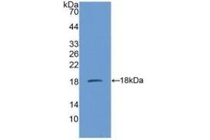 Detection of Recombinant SDHD, Mouse using Polyclonal Antibody to Succinate Dehydrogenase Complex Subunit D (SDHD)