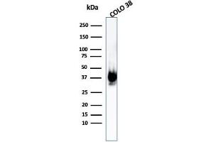 Western Blot Analysis of COLO-38 cell lysate using gp100 Rabbit Recombinant Monoclonal Antibody (PMEL/1825R). (Rekombinanter Melanoma gp100 Antikörper)