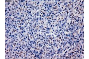 Immunohistochemical staining of paraffin-embedded lung using anti-EpCAM (ABIN2452677) mouse monoclonal antibody. (EpCAM Antikörper  (AA 24-265))