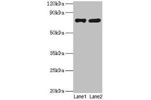 Western blot All lanes: PARN antibody at 2 μg/mL Lane 1: Jurkat whole cell lysate Lane 2: A431 whole cell lysate Secondary Goat polyclonal to rabbit IgG at 1/10000 dilution Predicted band size: 74, 67, 68, 53 kDa Observed band size: 74 kDa (PARN Antikörper  (AA 1-639))