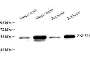 Western blot analysis of ZNF572 (ABIN7076268) at dilution of 1: 2000 (ZNF572 Antikörper)